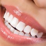 Teeth Whitening Services in Hunt Valley MD Area