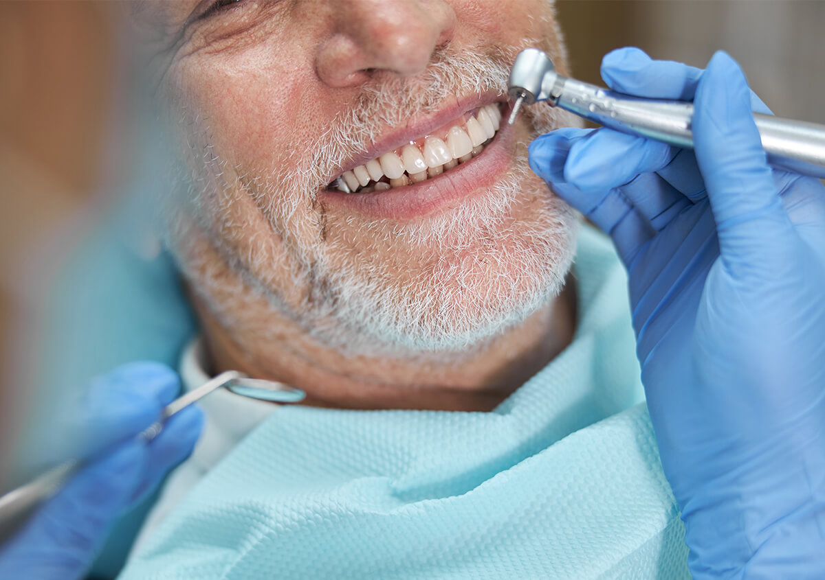 Dental Implant Surgery in Hunt Valley TN Area